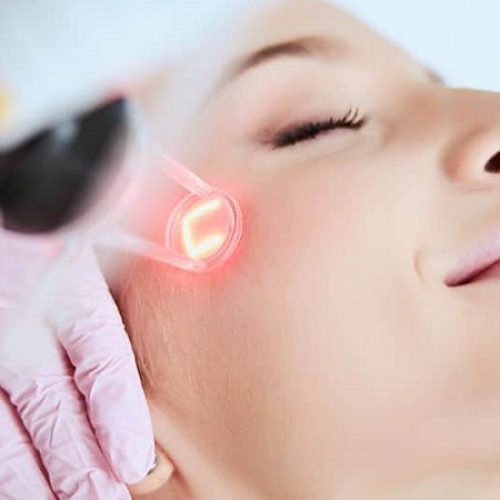 Fractional-Laser-with-PRP-Therapy-in-Riyadh-Saudi-Arabia